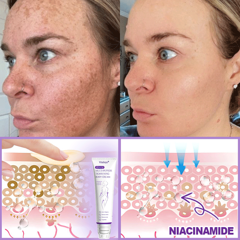 💎FDA Official: Vitalisys® PDRN Multi-Peptide Massaging Body Roller Cream- Anti-aging, Hydrating, Skin Firming & Lifting, Skin Repair, Even Tone, Acne and Dark Spot Treatment, Wart and Mole Removal, and Psoriasis Relief.