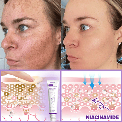 💎FDA Official: Vitalisys® PDRN Multi-Peptide Massaging Body Roller Cream- Anti-aging, Hydrating, Skin Firming & Lifting, Skin Repair, Even Tone, Acne and Dark Spot Treatment, Wart and Mole Removal, and Psoriasis Relief.