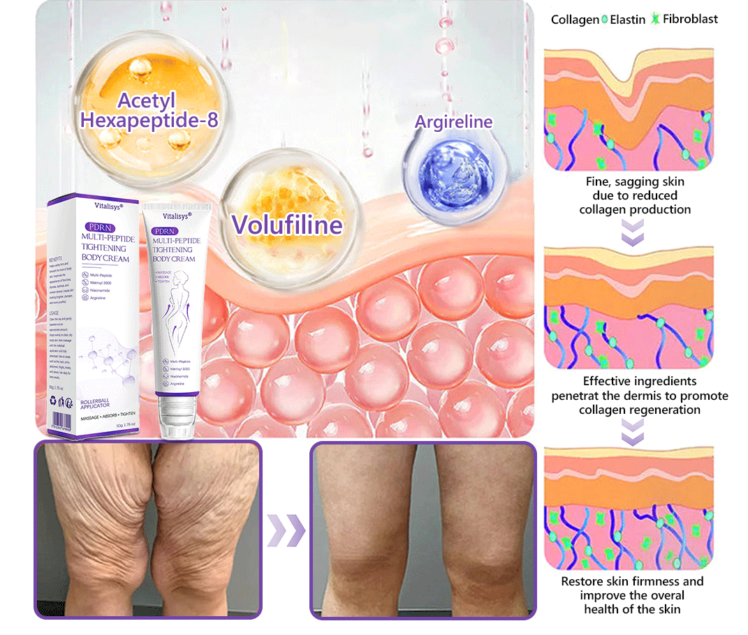 💎FDA Official: Vitalisys® PDRN Multi-Peptide Massaging Body Roller Cream- Anti-aging, Hydrating, Skin Firming & Lifting, Skin Repair, Even Tone, Acne and Dark Spot Treatment, Wart and Mole Removal, and Psoriasis Relief.