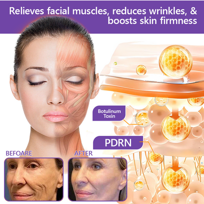 💎FDA Official: Vitalisys® PDRN Multi-Peptide Massaging Body Roller Cream- Anti-aging, Hydrating, Skin Firming & Lifting, Skin Repair, Even Tone, Acne and Dark Spot Treatment, Wart and Mole Removal, and Psoriasis Relief.