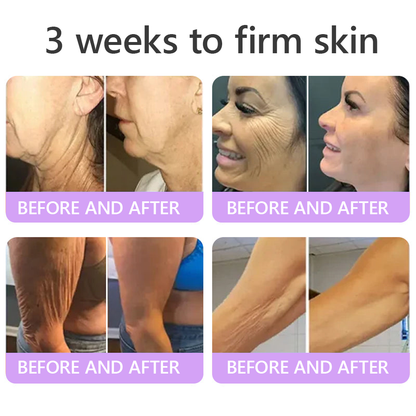 💎FDA Official: Vitalisys® PDRN Multi-Peptide Massaging Body Roller Cream- Anti-aging, Hydrating, Skin Firming & Lifting, Skin Repair, Even Tone, Acne and Dark Spot Treatment, Wart and Mole Removal, and Psoriasis Relief.