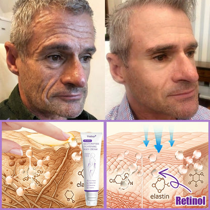 💎FDA Official: Vitalisys® PDRN Multi-Peptide Massaging Body Roller Cream- Anti-aging, Hydrating, Skin Firming & Lifting, Skin Repair, Even Tone, Acne and Dark Spot Treatment, Wart and Mole Removal, and Psoriasis Relief.